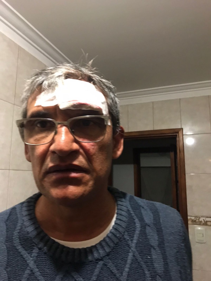 Sent como si me hubiesen pegado con un adoqun
